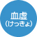 血虚