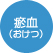 瘀血